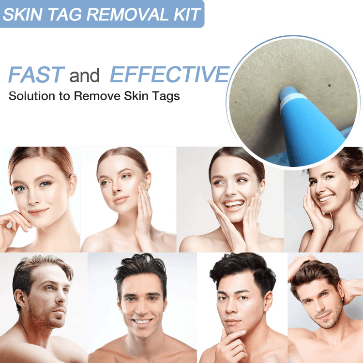 Painless Skin Tag Removal Kit for Safe At Home Skin Care Treatment